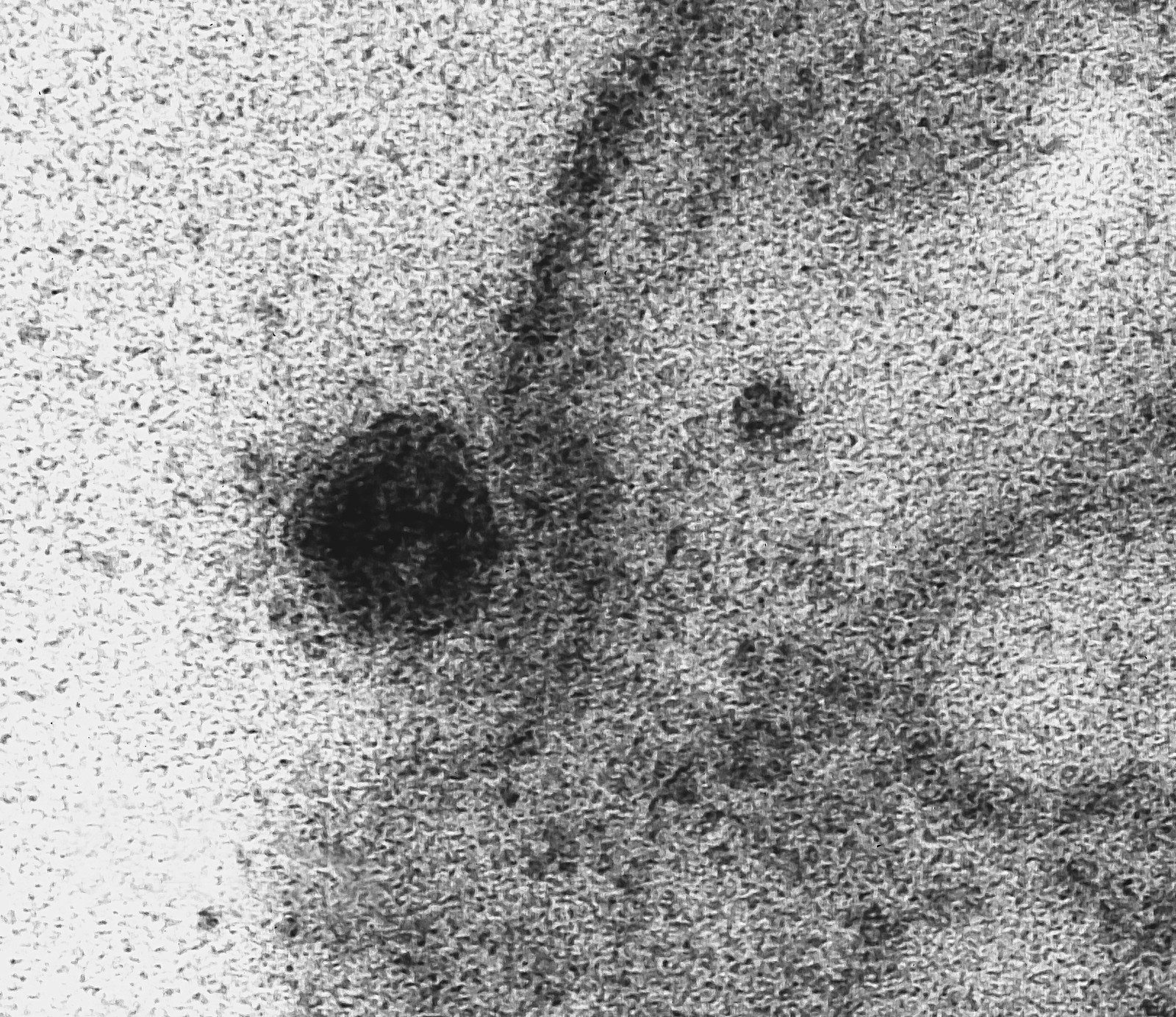 Estudo sobre mutação genética mostra que novo coronavírus se espalhou no final de 2019